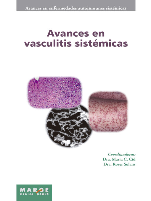 Title details for Avances en vasculitis sistémicas by Roser Solans - Available